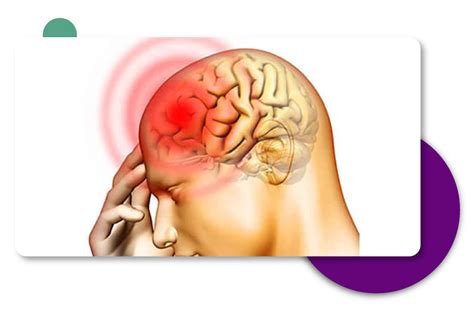 Brain Procedure Brain Hemorrhage Best Brain Hemorrhage Doctor