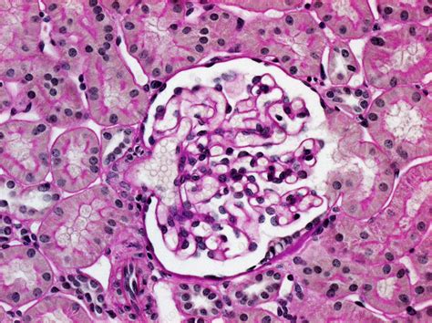 Kidney Glomerulus Light Micrograph Stock Image C0226810 Science