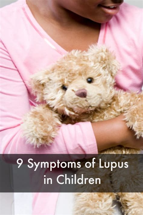 Lupus Symptoms In Children