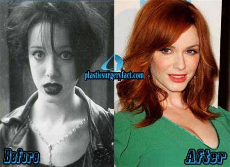 Christina Hendricks Plastic Surgery Before And After Photos