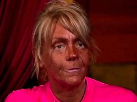 Tan Mom No More Patricia Krentcil Gives Up Tanning For Botox
