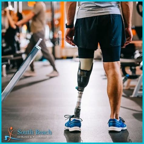 What You Should Know Before Getting A Prosthetic Leg South Beach
