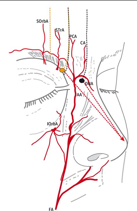Figure From The Midline Central Artery Forehead Flap A Valid