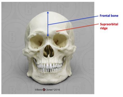 What Are The Bumps Or Indents In The Skull Just Above The Eyes