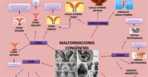 Evidencias de Gínecologia 2014 36 Mapa Conceptual TEMA MALFORMACIONES