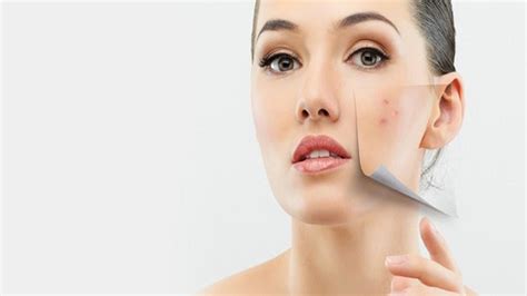 Apakah itu tanda kesholihan karena sangking banyaknya bersujud ataukah bagaimana? Noda Hitam di Wajah, Itu Termasuk Tanda Penuaan Dini ...