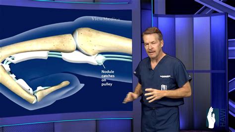 A disorder of the tendon of a finger that makes…. Trigger Finger Surgery - YouTube