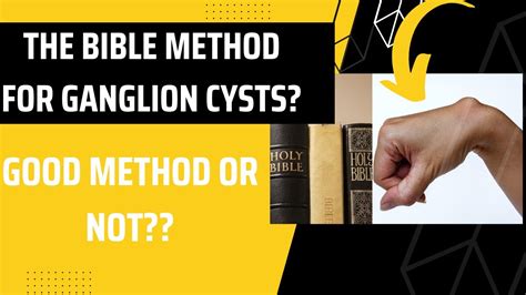Bible Method For Ganglion Cysts Youtube