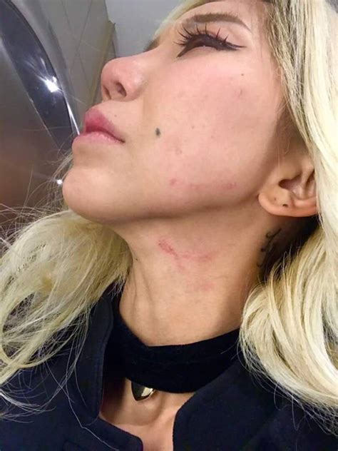When your boyfriend neglects you, it is the worst! DJ Leng Yein posts horrific photos, alleging abuse at the ...