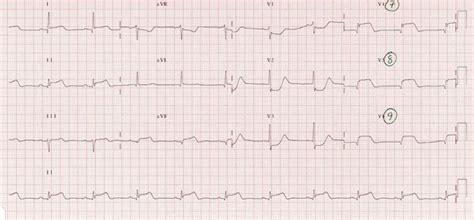 Pin On Cardiology