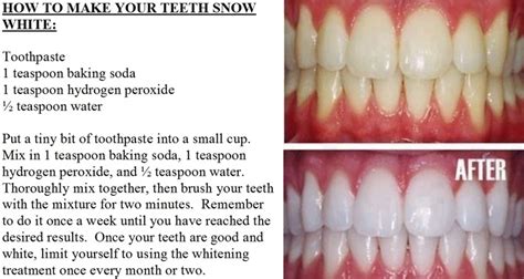 We know that it's frustrating when you notice your teeth aren't as white as they used to be, but luckily, there are a lot of ways you can get. How To Make Your Teeth Snow White | Beauty tips and ...