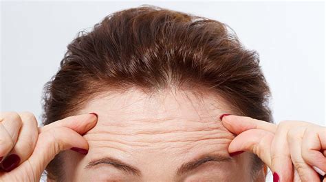 10 Ways To Effectively Reduce Forehead Wrinkles That Dont Cost A Fortune