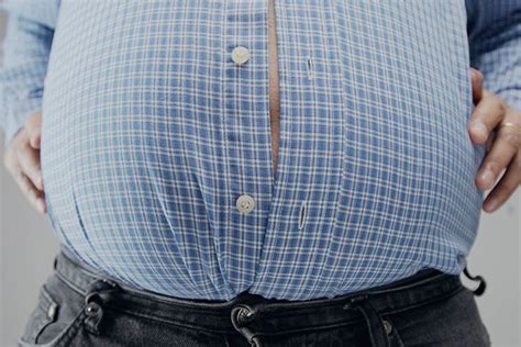 Treatments For Obesity 5 Options To Consider If You Are Obese