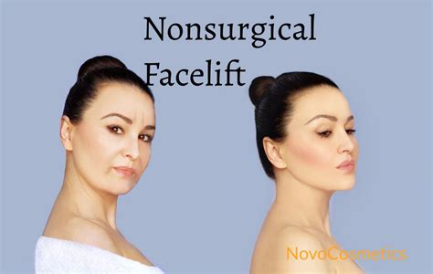 Non Surgical Face Lift Novo Cosmetics