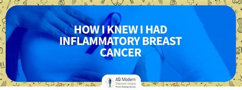 How I Knew I Had Inflammatory Breast Cancer Aqmdi Blogs