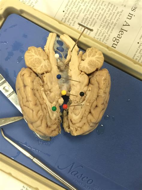 The Best Of Anatomy Brain Dissection Anaylsis