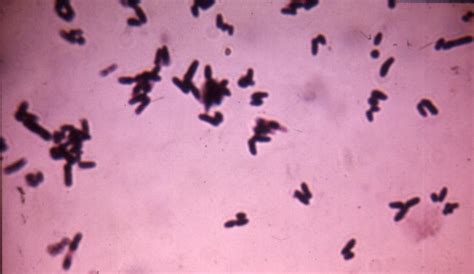 Bsci 424 Pathogenic Microbiology Corynebacterium