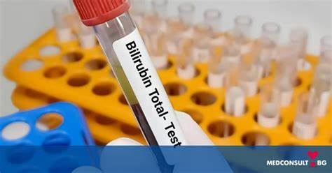 Билирубин и диета