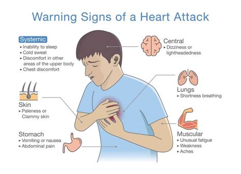 Heart Attack Pain Diagram Photos Cantik