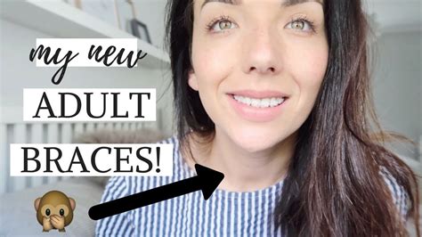 I Got Adult Braces Clear Ceramic Braces Before And After Youtube