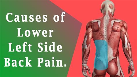 Lower Back Pain Left Side Causes Of Lower Left Side Back Pain Youtube