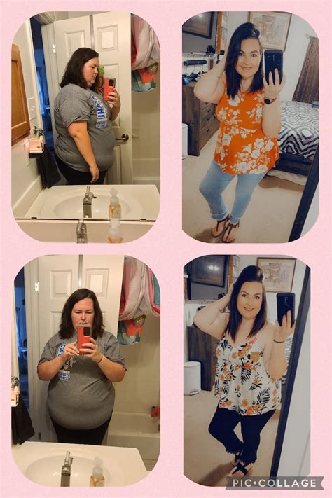 Gastric Sleeve Weight Gain After Years Blog Dandk