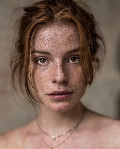 Freckled Beauties Freckles Girl Beautiful Freckles Freckles
