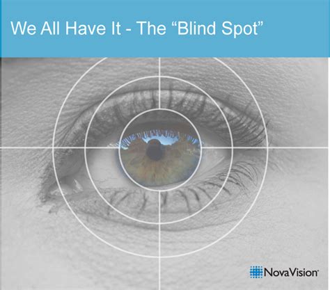 What Are Blind Spots In The Eye Home Interior Design