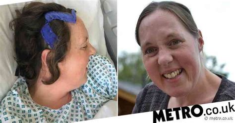 Woman Who Thought She Had Sunstroke Discovers Symptoms Were Caused By Deadly Brain Tumour Uk