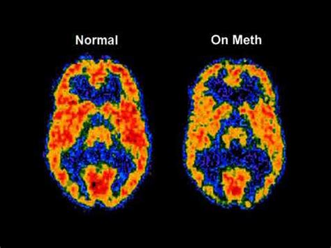 A simple answer is all i'm looking for so please refrain from judgemental lectures as they will fall on deaf ears. How Meth Affects the Body (2009-01-12)
