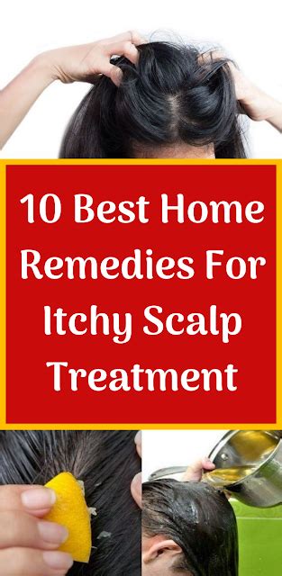 Herbal Medicine 10 Best Home Remedies For Itchy Scalp Treatment