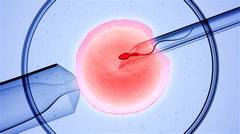 What You Need To Know About In Vitro Fertilization IVF Process