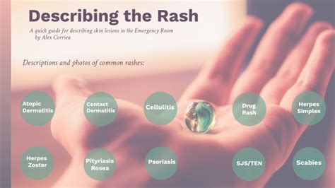 Describing The Rash By Alexanra Corriea