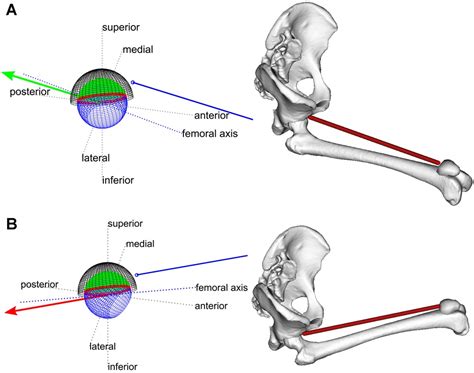 Hip Abduction Can Prevent Posterior Edge Loading Of Hip Replacements