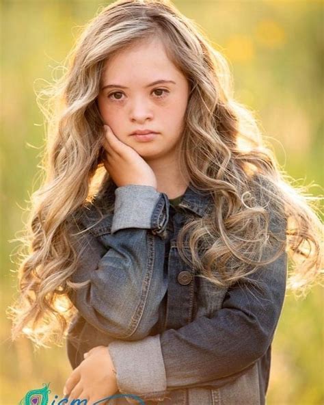 Teen Model With Down Syndrome Is Breaking Barriers With High Profile