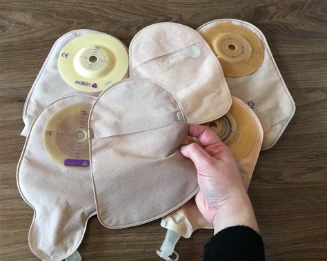 Tips For Getting Your Stoma Pouch To Stick Ostomy Support A Bigger Life