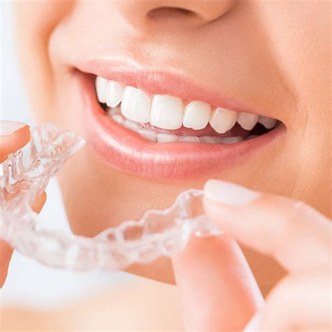 Invisalign Vs Braces Which One Is Best For You