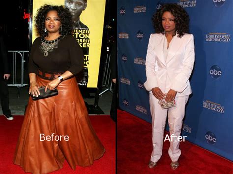 Oprah Winfrey Nose Job Before And After Photo Celebrity Plastic Surgery