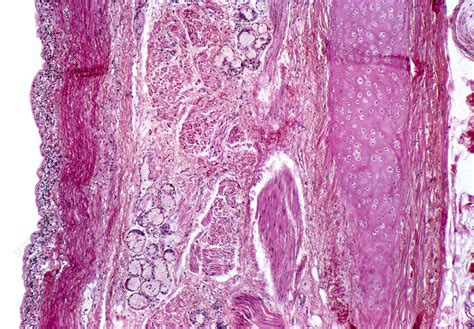 Lm Of Human Tracheal Epithelium Stock Image P5800044 Science