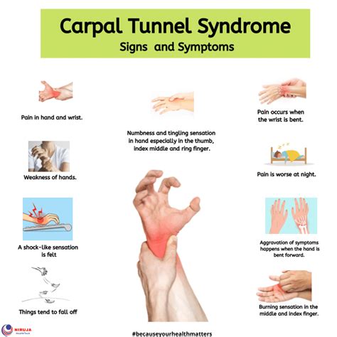 Carpal Tunnel Syndrome Signs And Symptoms Rinfographics