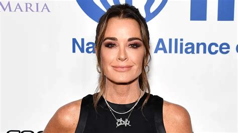 kyle richards weight loss the rhobh star underwent this surgery check out
