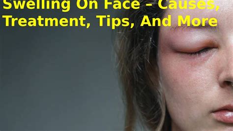 Swelling On Face Causes Treatment Tips And More