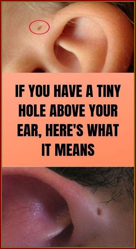 Have A Tiny Hole Above Your Ear Artofit