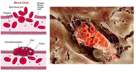 75 Blood Clotting Biology Notes For Igcse 2014 And 2024
