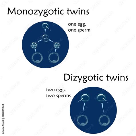 Multiple Pregnancy Dizygotic And Monozygotic Twins Fertilized Eggs Sperm Vector Medical