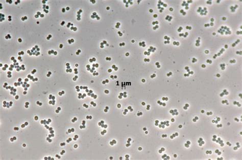 Staphylococcus Warneri E14b Dsm 30869 Bacdiveid14592