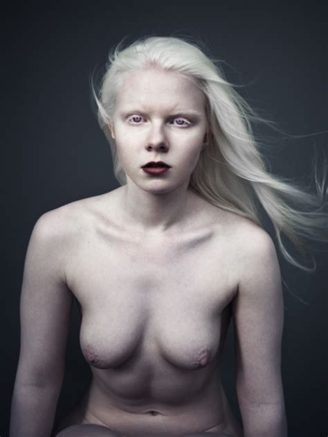 Naked Albino Female Porn Very Hot Gallery Site Comments 1