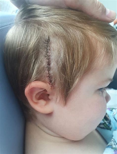Boy 4 Diagnosed With Rare Inoperable Brain Tumour After Collapsing At