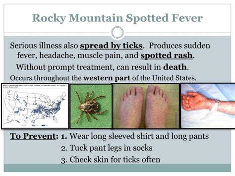 Rocky mountain spotted fever (rmsf) is an infection caused by the bite of an infected tick. PPT - C 135 6-10 PowerPoint Presentation - ID:2319231