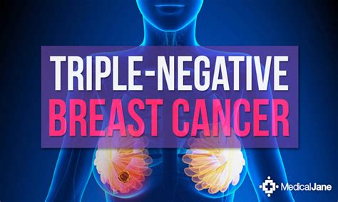 These subtypes of breast cancer are normally diagnosed based upon the presence, or absence of, three receptors known to sustain most breast cancers: Cannabinoid Treatments vs Triple-Negative Breast Cancer